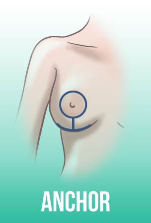 подтяжка груди киев хирург