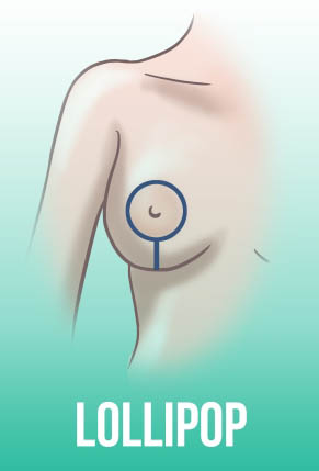 подтяжка груди украина хирург