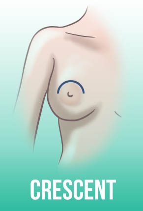 коррекция соска киев пластический хирург